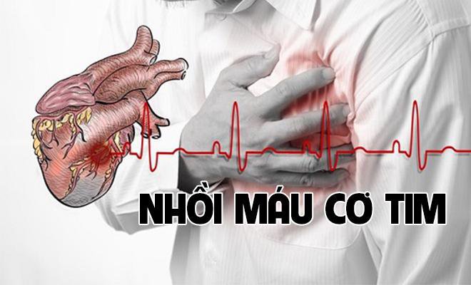Những dấu hiệu nhận biết bệnh nhồi máu cơ tim, ai cũng nên thận trọng